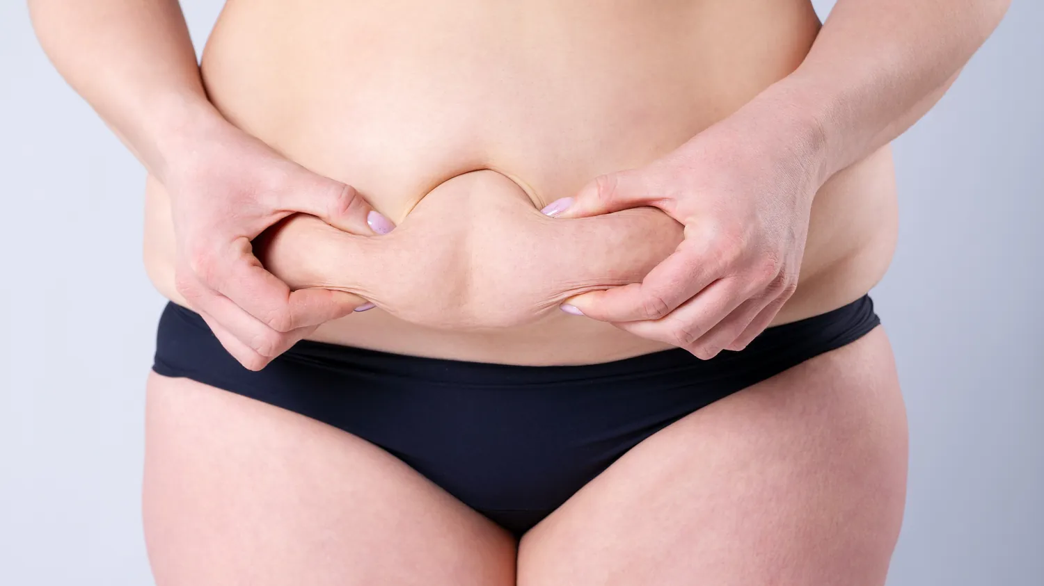 ABDOMINOPLASTY 